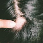 Qual melhor shampoo para queda de cabelo